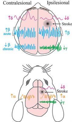 Driving Oscillatory Dynamics: Neuromodulation for Recovery After Stroke